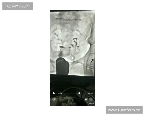 朱婷随手点杯咖啡，价钱直接能帮我还房贷一个月